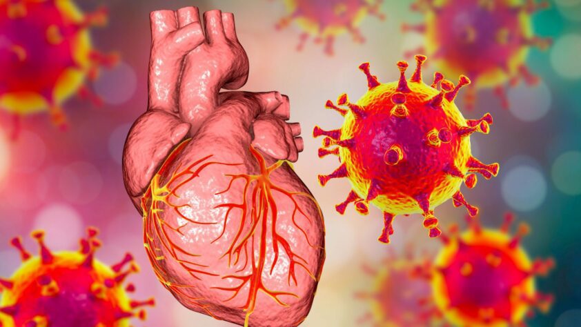 Hartspierontsteking en ontsteking van het hartzakje na mRNA-vaccin - 26751